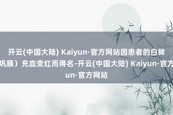 开云(中国大陆) Kaiyun·官方网站因患者的白眸子（巩膜）充血变红而得名-开云(中国大陆) Kaiyun·官方网站