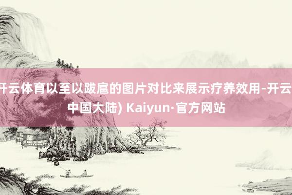 开云体育以至以跋扈的图片对比来展示疗养效用-开云(中国大陆) Kaiyun·官方网站